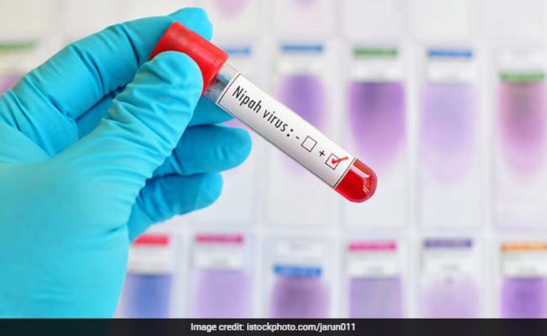 nipah-virus-istock_625x300_1526880384736.jpg